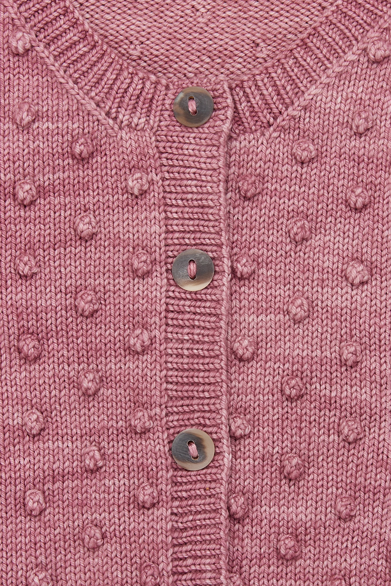 Button Mending - Image 3